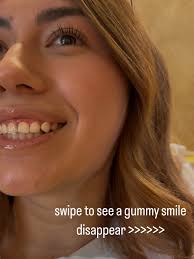 WELCOME!!! Dr. Rachel Findlay to the practice. We are excited to have her  joining Dr. Bjork. She brings extraordinary skill sets that will provide  great advantages for many of our patients! Bio: