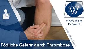 Die Todliche Gefahr Durch Thrombose Ursachen Symptome Tipps Bei Tiefer Beinvenenthrombose Tvt Youtube