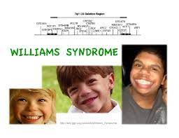Williams Syndrome