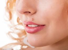Stretch marks, also known as striae, are scars that appear on various parts of your skin, primarily around your stomach, thighs, hips, breasts, upper arms, lower back and calves. Is It A Beauty Mark Or Skin Cancer
