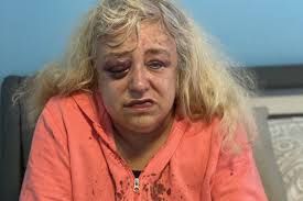 Fundraiser for Brittany Klemm by Jessica Baker : Medication & Somewhere to  Live for Annette