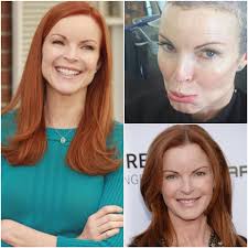 By celebsofworld · published december 14, 2020. Gossip Room L Actrice Marcia Cross A Annonce Etre Facebook