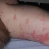 Hantavirus can be found in areas where wild rodents are seen. Https Encrypted Tbn0 Gstatic Com Images Q Tbn And9gctx4slvawwifa9lppatgl5zkohkdvi0ga1donfzhs5ukx8snsag Usqp Cau