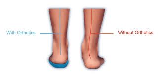 Image result for Orthotic