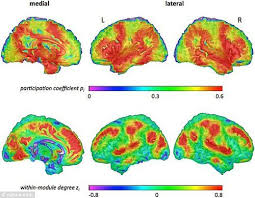 Les Gens Intelligents Ont Le Cerveau Mieux Cable Que Les Autres