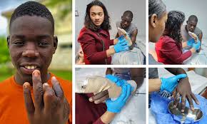 Update: Lionel's Hand