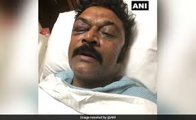 Kampli mla jn ganesh, who is absconding since last sunday after he assaulted his fellow party mla anand singh, is said to have given the police the slip three times. Case Against Karnataka Congress Mla Jn Ganesh For Attacking Another Mla Anand Singh Ganesh Is Absconding