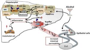 Alcoholic Hepatitis An Overview Sciencedirect Topics