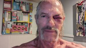 Fundraiser for Ginger S by Thomas Hanlon : Help our friend Pete Stendel