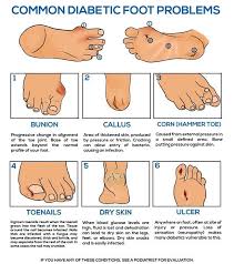 Pin On Diabetic Foot Care