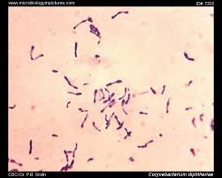 Image result for Corynebacterium