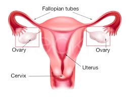 A dermoid ovarian cyst is a benign tumor of the ovary. Ovarian Cysts Pelvic Masses Dr Seckin