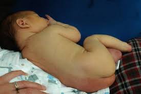 Image result for Harlequin Color Change