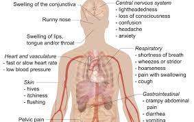 It's important to know about because it can happen quickly and be very. Anaphylaxis Dr Caterina Detoraki Zerodonto