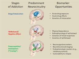 Image result for Addiction Pathophysiology