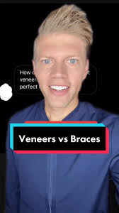 Veneers vs Braces: Choosing the Best Option for Your Smile