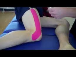 We provide innovative solutions to our customers and collaboration partners in the area of. How To Treat Runners Knee Iliotibial Band Friction Syndrome With Kinesiology Tape Cute766