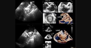 Bildergebnis für Morris Zerner