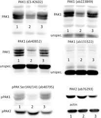 Browse relevant sites & find native instruments kontakt. Pak1 Pak1d15 And Pak2 Similarities Differences And Mutual Interactions Biorxiv
