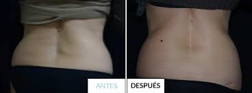 We did not find results for: Que Es Hifu Doctora Mercedes Silvestre