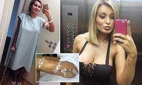 Fortunately, andressa urach is not one of those women, as you'll see in these hot pics of her showing off her curvaceous body in tight skimpy outfits seemingly every time she's at the airport. Andressa Urach Turns To Religion After Filler Injections Nearly Killed Her Daily Mail Online