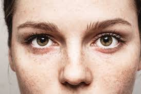 Coronavirus transmission from the eyes is unlikely. Myhealth1st Your Eyes Could Be The Window To Covid 19