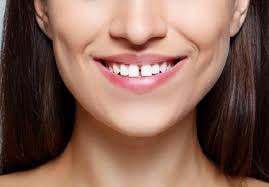 Now there is a new technique teeth gap filling, how to fill gap between teeth at home, way to fill your teeth gap,दांतों के बीच गैप. Gap Between Front Teeth Causes And Best Treatment Options Thehealthsite Com