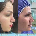 dreinabadi 👃راینوپلاستی 👨‍⚕️ دکتر وحید عین آبادی متخصص جراحی ...