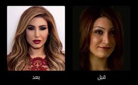 وهذه البنوك سوف تحصل على ذلك مجانا. ØµÙˆØ± ØµØ§Ø¯Ù…Ø© ÙÙ†Ø§Ù†Ø§Øª Ø¹Ø±Ø¨ Ù‚Ø¨Ù„ ÙˆØ¨Ø¹Ø¯ Ø¹Ù…Ù„ÙŠØ§Øª Ø§Ù„ØªØ¬Ù…ÙŠÙ„ Ø¯Ù†ÙŠØ§ Ø§Ù„ÙˆØ·Ù†