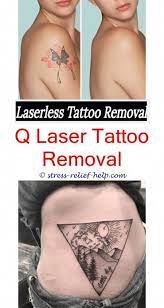 This technique removes the top and the skin's middle layers that contain the pigment. How To Remove A Permanent Tattoo Without Laser How Is A Tattoo Removed By Laser Tattoo Removal Surrey Tattoo Removal Tattoos Diy Tattoo Diy Tattoo Permanent