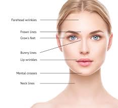 Vancouver botox injections