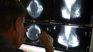 Check spelling or type a new query. New Mammogram Guidelines For Women Recently Vaccinated For Covid 19