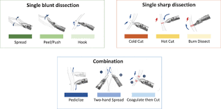 Image result for Blunt Dissection