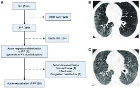 Patient Flow Chart And Chest X Ray And High Resolution