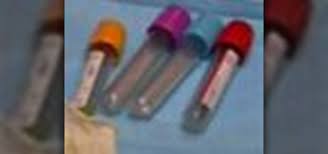 How to draw blood step 1: How To Draw Blood With Three Different Phlebotomy Techniques Medical Diagnosis Procedures Wonderhowto