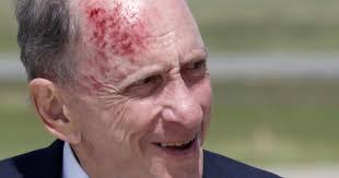 Frank Bures: Comparing actinic keratosis treatments