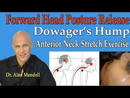 Forward Head Posture Release Dowager S Hump Anterior Neck Stretches Dr Mandell Forward Head Posture Dowager Hump Neck Exercises
