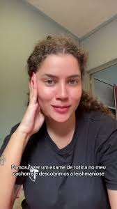 Exame Sorologico Elisa E Rifi Leishmaniose Cachorro