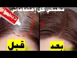 معجون الاسنان والبصل سيخلصك نهائيا وللابد من الشيب حتي لو الشعر كله ابيض علاج الشيب بسرعة Youtube