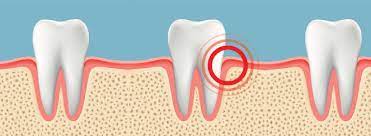 Gum Pain Causes, Relief, And Treatments - Crest