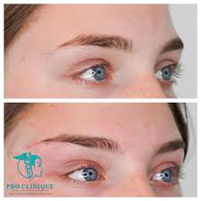 On youtube, popular makeup gurus like brianna fox and sagonia lazarof demonstrate how to achieve the look. Pro Clinique Ogonbrynslyft Med Tradar Fox Eyes Facebook
