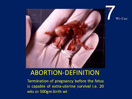 With more blood vessels forming in your pelvic region it can be easy to mistake implantation bleeding for a light period, but this type of spotting is in fact an early sign of pregnancy. Blood Wikipedia