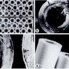 Almost every pack has had something wrong with it. Pdf Glass Fiber Contamination Of Cigarette Filters An Additional Health Risk To The Smoker