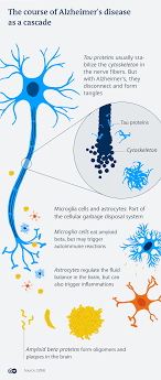 Alzheimer disease is becoming more common as the general population gets older and lives longer. H2igrmbxjwlxgm
