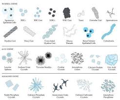 Cells In Urine Sediment Medical Technology Medical Lab Technician Medical Laboratory Technician