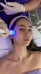 No pricking with DERMAX Hf ProFacial ✨️