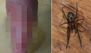 Learn how to spot them, what their bites feel and look like, and how important: Mum In Hospital From False Black Widow Terrorising Waterford Homes