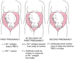 rh factor definition of rh factor by medical dictionary