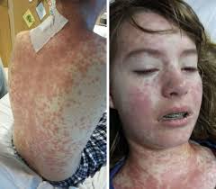 Mum releases horrific photos of teen daughter hoping to identify her  debilitating illness
