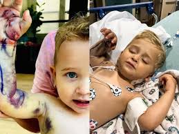 2 साल के बच्चे को जहरीले सांप ने काटा, इलाज से बच गई जान, पर खर्च करने पड़े  इतने रुपये, सोच भी नहीं सकते!